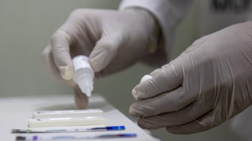 Invierte Sesa más de 9 mdp en atención a personas con VIH