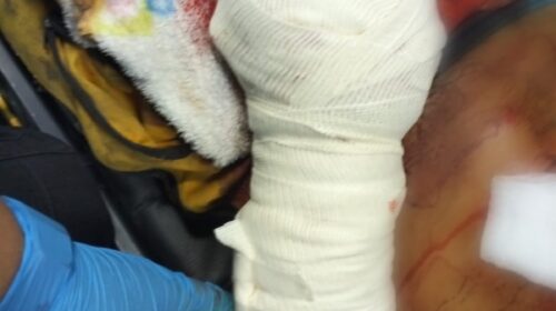Atiende Protección Civil de Tlaxco a persona lesionada por uso de pirotecnia en Zotoluca